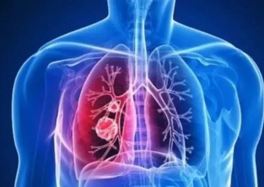 2025'te Grip, Astım ...